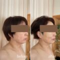 新メニュー！小顔・キュッとたるみ引き上げフェイシャル